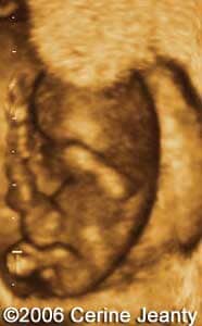10w1d.5