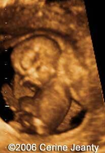 11w0d.2
