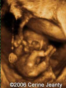 11w2d.1