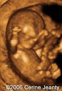 11w2d.4