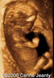 11W4D.2
