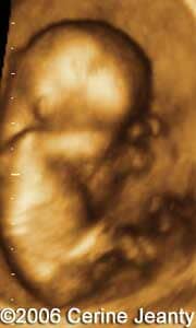 12w2d.1