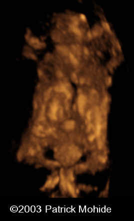 12wk_conjoined