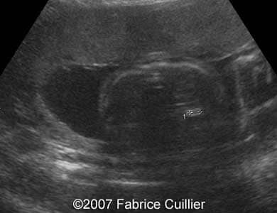 1C