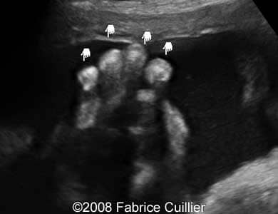 1D