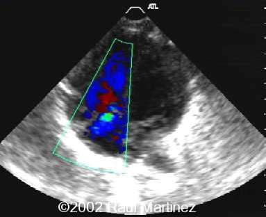 1neonatal1