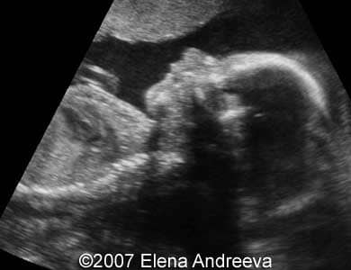 21weeks-profile