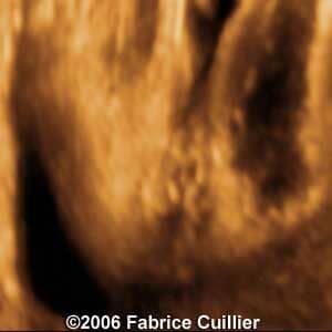 23weeks.2