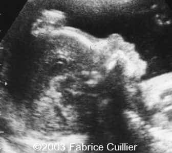 24 SA PROFIL FACE - FIG 3