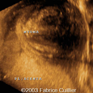 24SA FIB_3