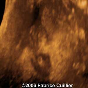 25weeks