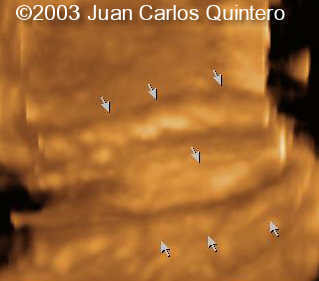 3 d a chiari