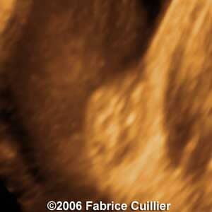 30weeks1