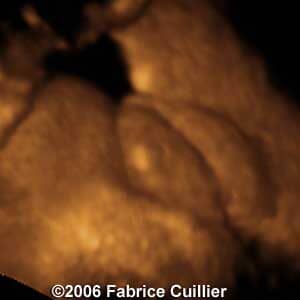 32weeks3