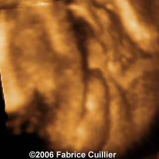 32weeks4