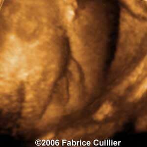 33weeks