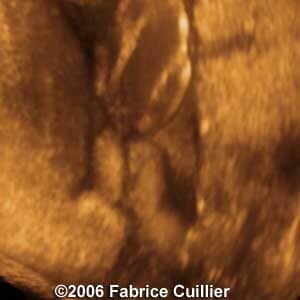 33weeks2