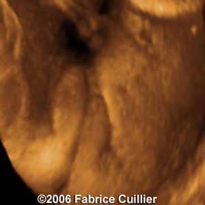 34weeks