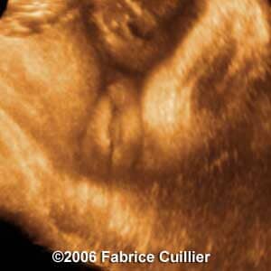 34weeks2