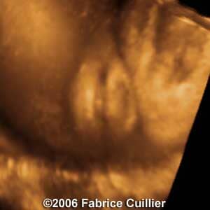 35weeks