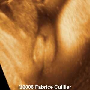 36weeks1