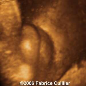 38weeks2