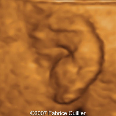 3B