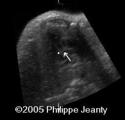 3d-9