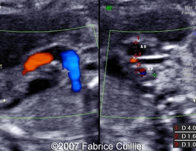 3F