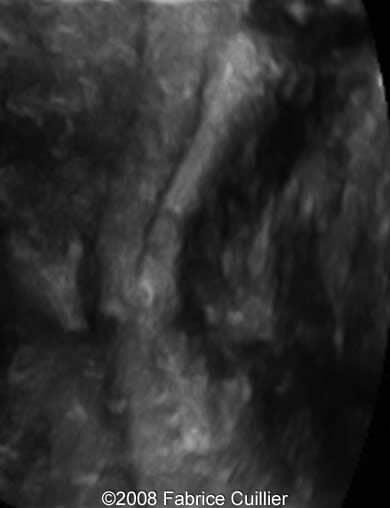 6B