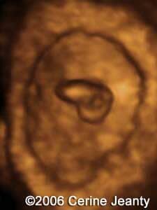 6w0d.5