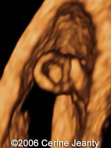 6w3d.1