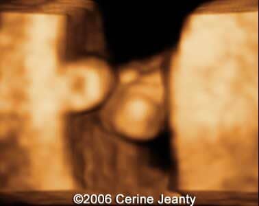 6w4d.2