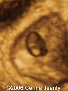 6w5d.2