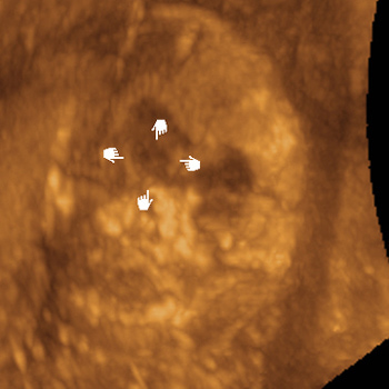7d