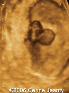 7w1d.3