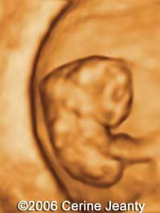 7w5d.1.