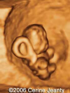 7w5d.2.