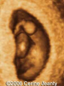 7w6d.1
