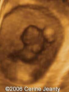 8w2d.1