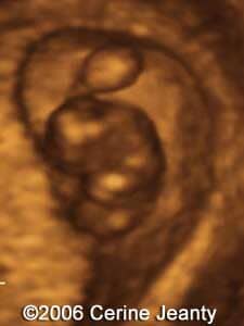 8w2d.2