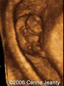 8w3d.2