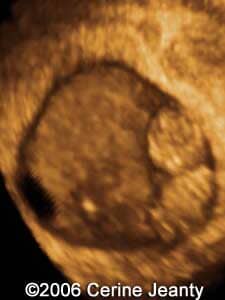 8w3d.4