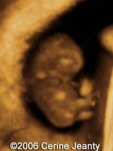 8w4d.3