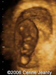 8w5d.1