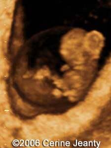 8w5d.2