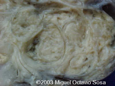 9B