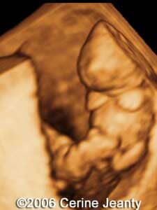 9w1d.3