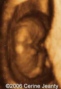9w2d.1