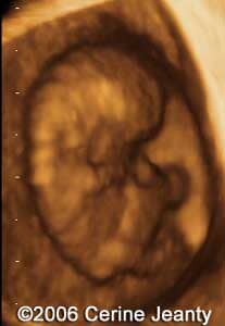 9w2d.2
